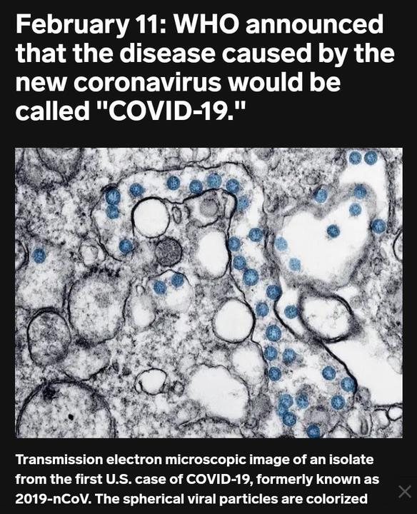 COVID-19 AMERIKA : sembuh dengan PLASMA COVALESCENT (model jaman doeloe)