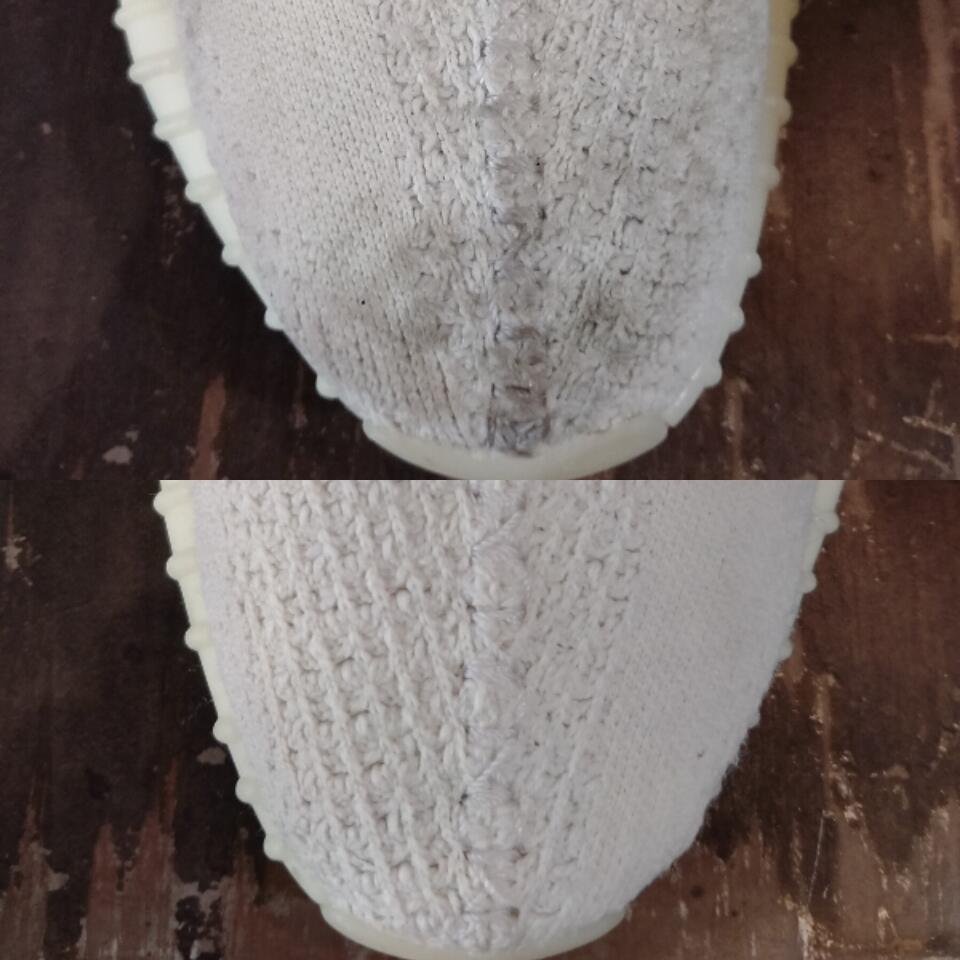 Whitening & Unyellowing treatmrnt