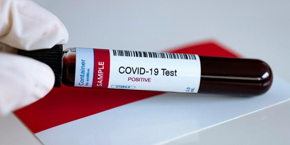 Daftar Rumah Sakit di Serpong yang Menyediakan Layanan Rapid Test COVID-19