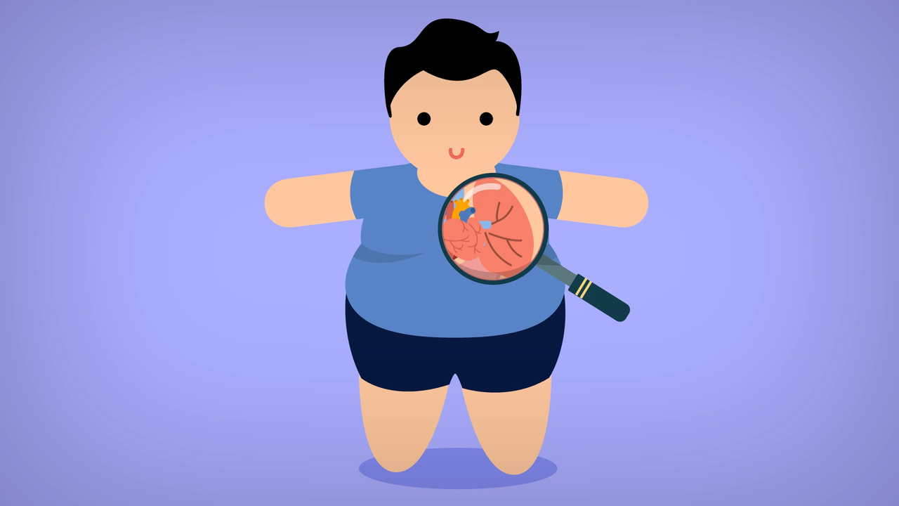 Ini dia DIET yg Tepat untuk OBESITAS