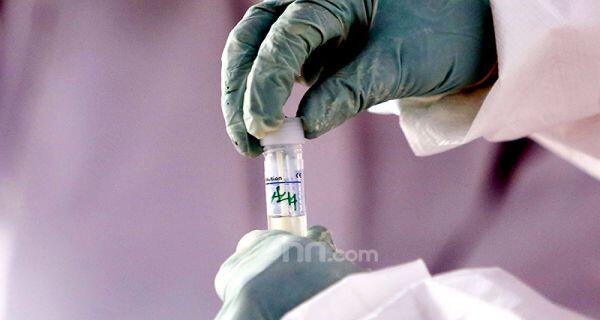 2 Pedagang di Kota Bekasi Positif Corona, yang Pernah Interaksi Segera Melapor