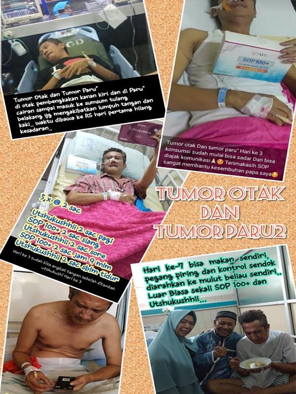 🔴 SOP100+ by AFC Life Science. | Solusi Kesehatan Anda | 100% Made in Japan