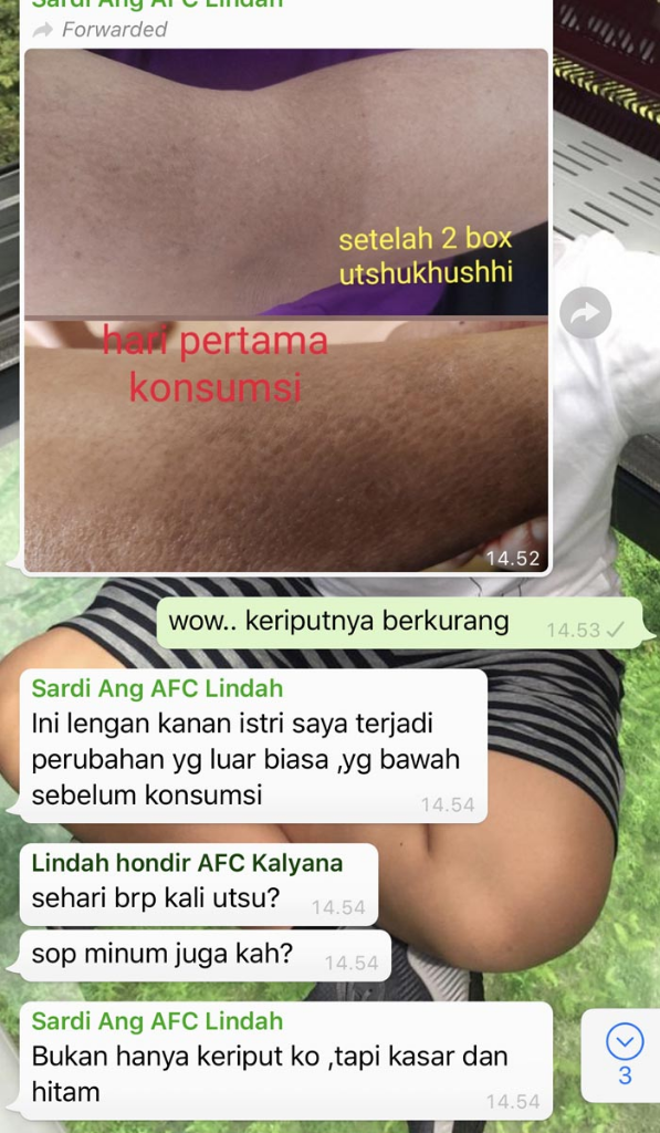 🔴 SOP100+ by AFC Life Science. | Solusi Kesehatan Anda | 100% Made in Japan