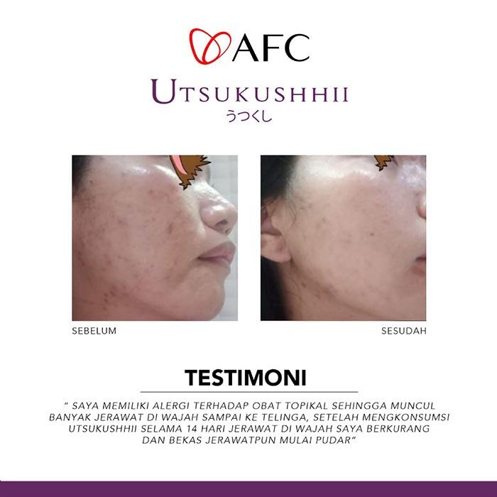 🔴 SOP100+ by AFC Life Science. | Solusi Kesehatan Anda | 100% Made in Japan