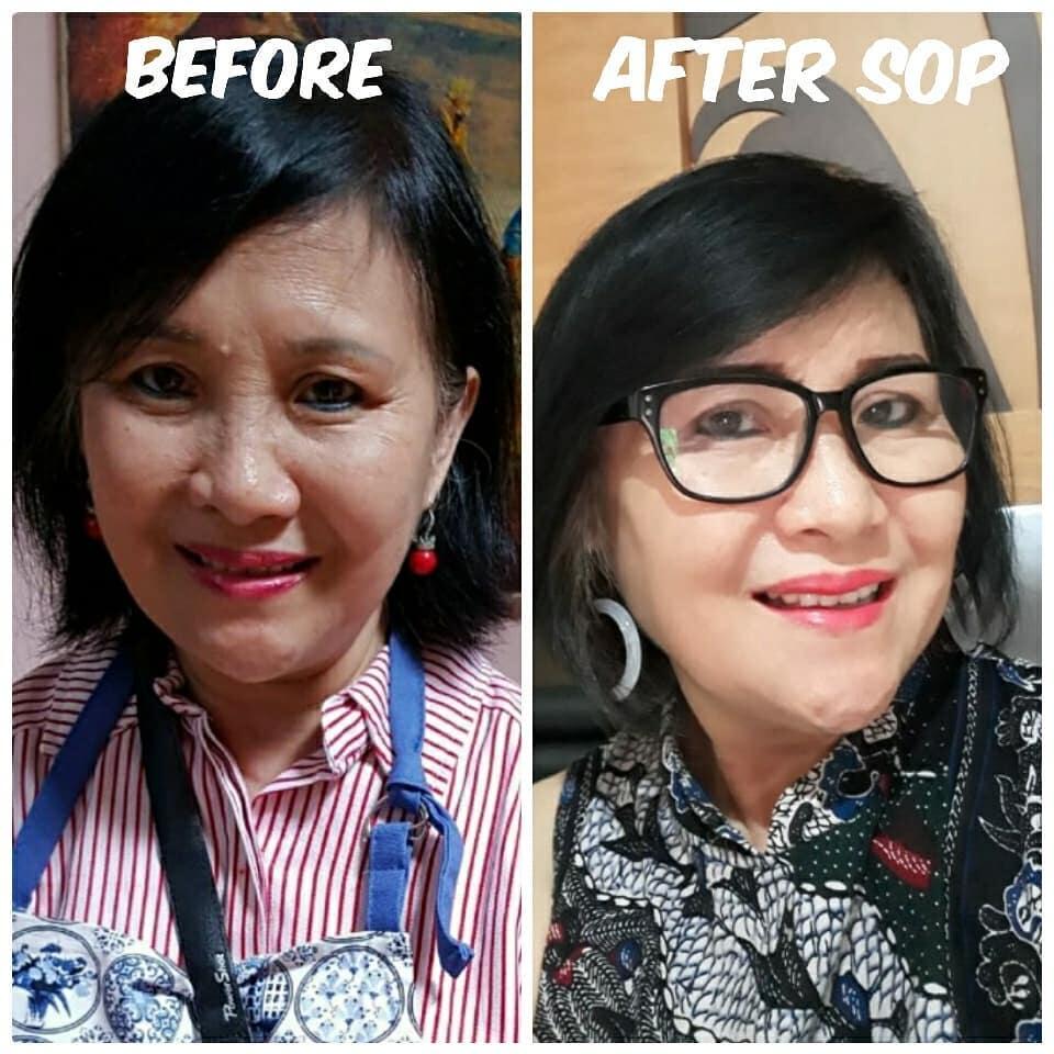 🔴 SOP100+ by AFC Life Science. | Solusi Kesehatan Anda | 100% Made in Japan
