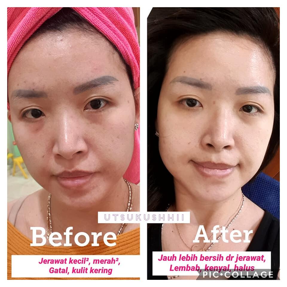 🔴 SOP100+ by AFC Life Science. | Solusi Kesehatan Anda | 100% Made in Japan