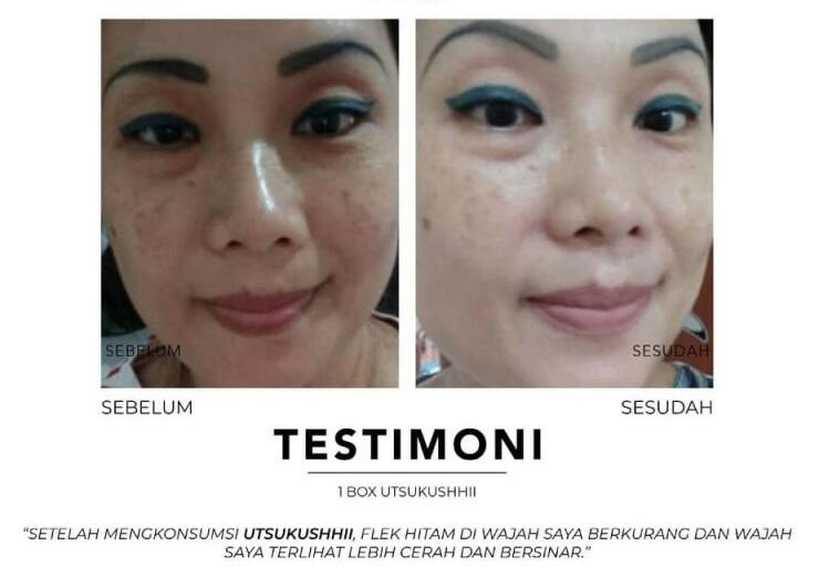 🔴 SOP100+ by AFC Life Science. | Solusi Kesehatan Anda | 100% Made in Japan