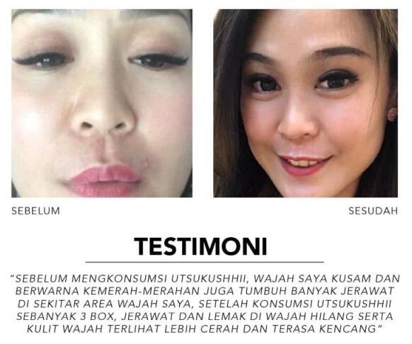 🔴 SOP100+ by AFC Life Science. | Solusi Kesehatan Anda | 100% Made in Japan