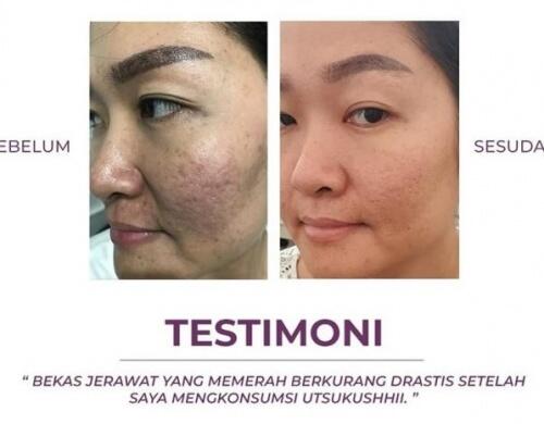 🔴 SOP100+ by AFC Life Science. | Solusi Kesehatan Anda | 100% Made in Japan