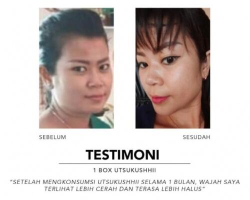🔴 SOP100+ by AFC Life Science. | Solusi Kesehatan Anda | 100% Made in Japan
