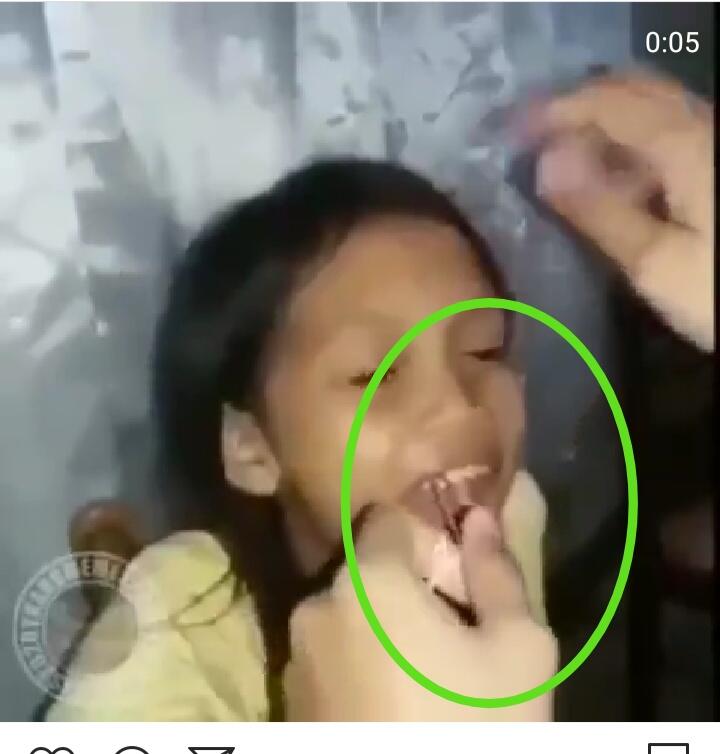 Viral Video Mencabut Gigi Dengan Cara Tradisional Gimana Reaksi Si Anak Awas Ngilu Kaskus