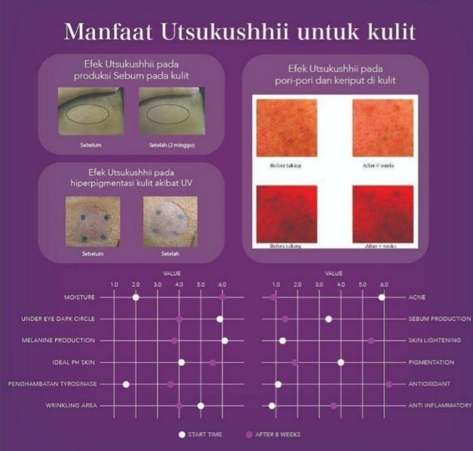 UTSUKUSHII : KECANTIKAN KULIT TERPANCAR DARI USUS YANG SEHAT