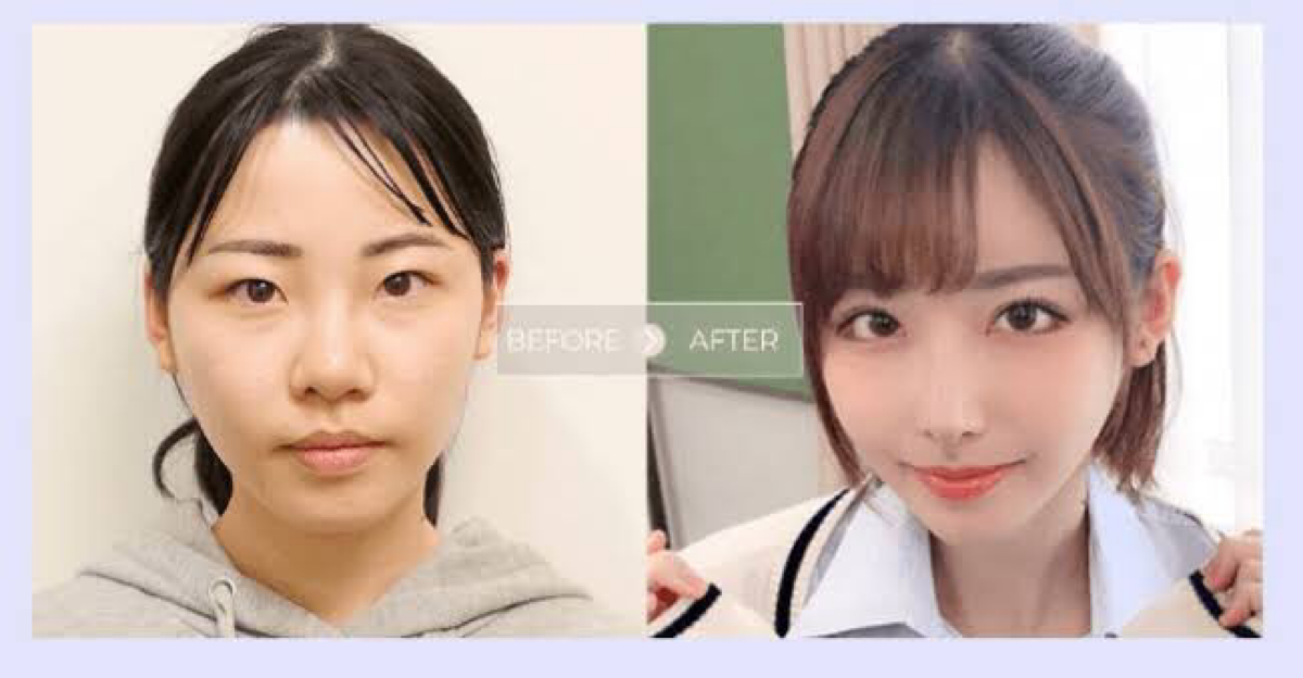 Morberplz Plastic Surgery