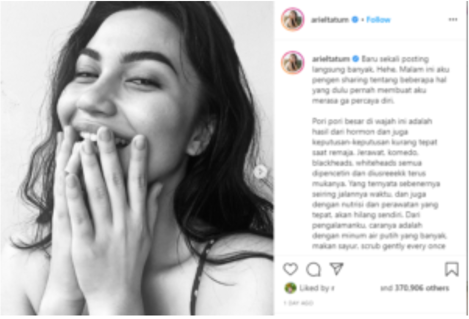 Ariel Tatum Pamer Bagian Tubuh yang Bikin Insecure, Netizen Ucap Syukur