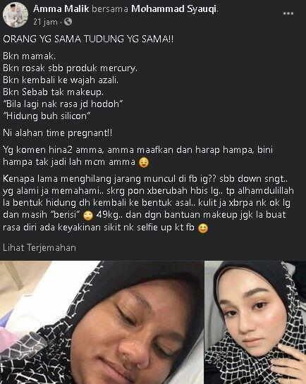 Ngaku Alergi saat Hamil, Paras Wanita Ini Berubah Drastis usai Melahirkan