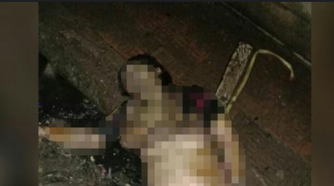 6 Fakta Mengejutkan Wanita Dibakar Hidup-hidup, Korban Tak Henti Istigfar