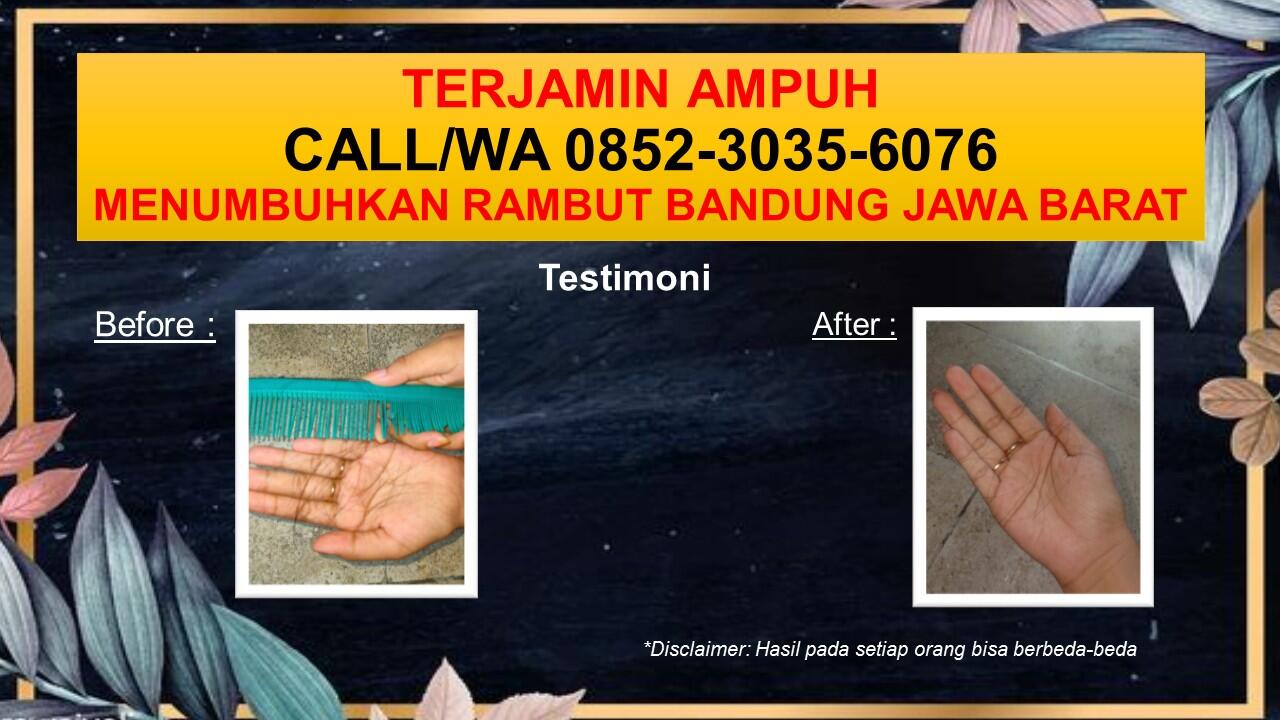 SOLUSI TERPERCAYA, CALL/WA 0852-3035-6076, Serum Penumbuh Rambut Bandung Jawa Barat 