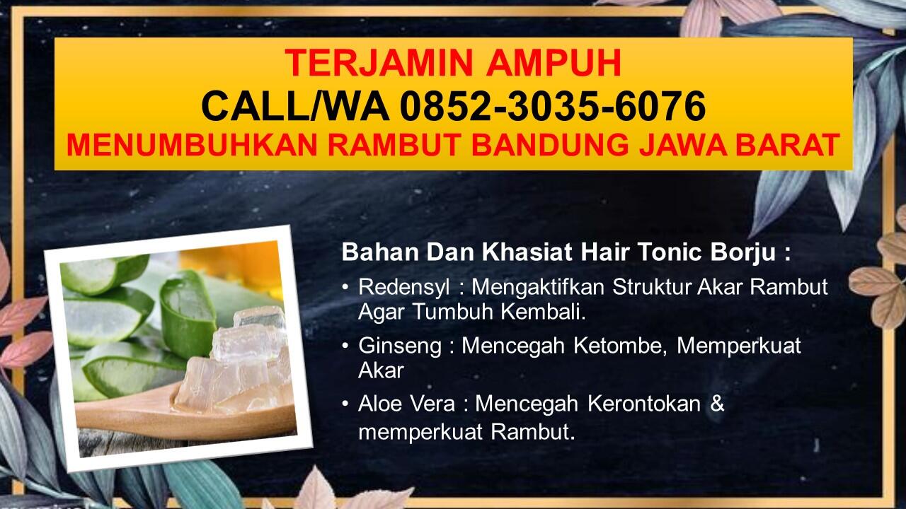 JAMINAN UANG KEMBALI 90 HARI, CALL/WA 0852-3035-6076, Herbal Penumbuh Rambut Bandung