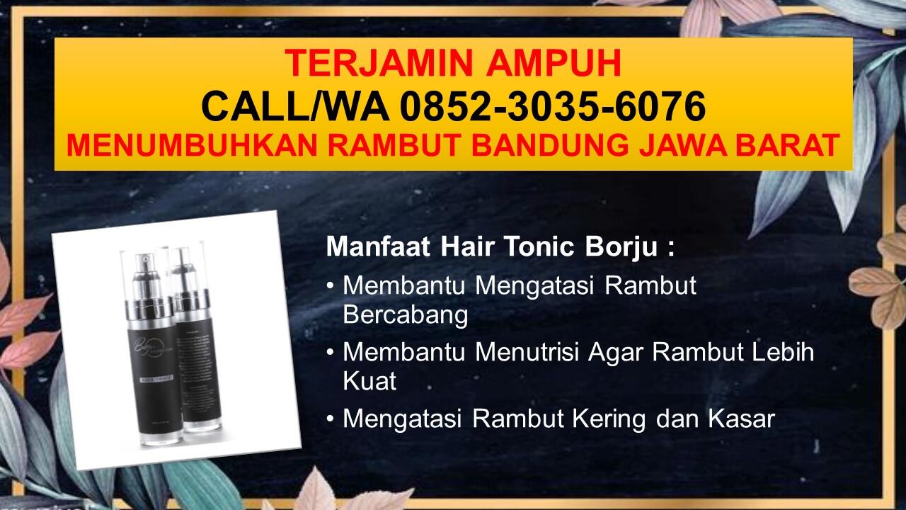 TERBUKTI NYATA, CALL/WA 0852-3035-6076, Hair Tonic Penumbuh Rambut Bandung Jawa Barat