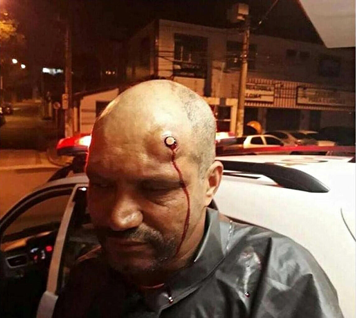 Apa Yang Terjadi Jika Kepala Kita Tertembak Pistol? Sini Masuk! 