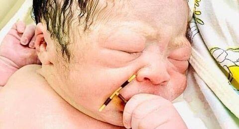 Bayi Ini Keluar dari Rahim Ibunya Sambil Pegang Alat Kontrasepsi