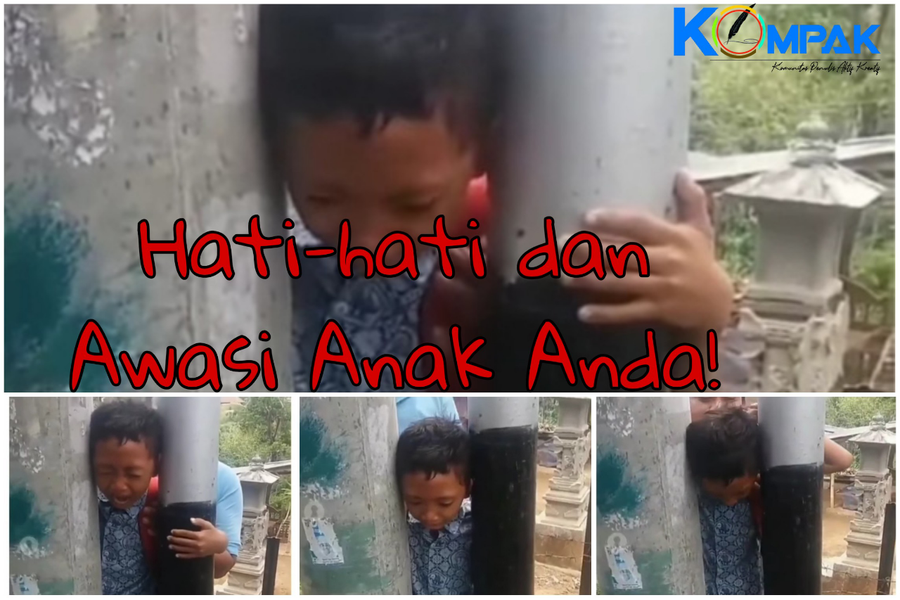 Bisa Masuk Tak Bisa Keluar, Kepala Anak Ini Terjebak di Antara Tiang Listrik! 