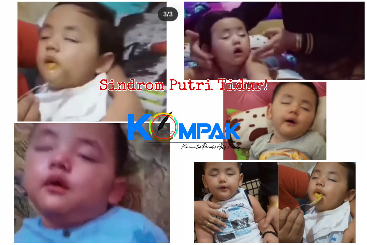 Kisah Haru Pengguna Tik Tok, Shaka Bayi Pengidap Sindrom Putri Tidur! Adakah Obatnya?