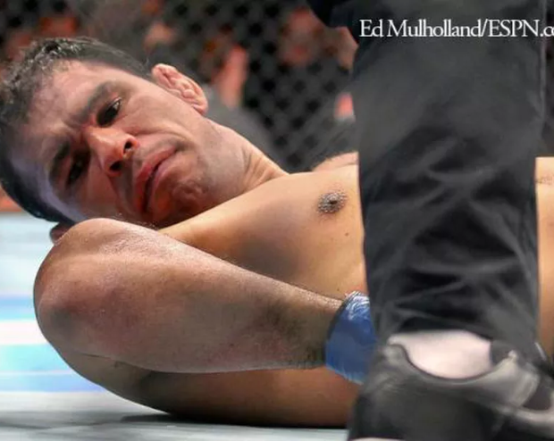 Lima Cedera Paling Mengerikan Yang Pernah Terjadi Dalam Pertarungan MMA Di UFC