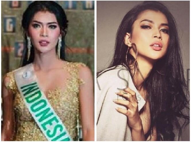 Heboh Pengakuan Dinda Syarif Soal Operasi Kikis Jakun hingga Potong Kelamin