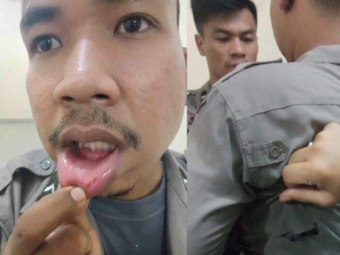 Coba Melarikan Diri, Tujuh Tahanan Hajar Polisi Hingga Bonyok