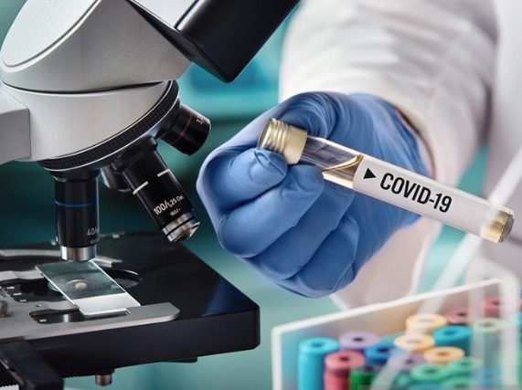 27 Kandidat Vaksin Covid-19 di Dunia Masuk Tahap Uji ke Manusia