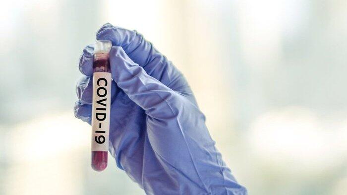 Benarkah Klaim Hadi Pranoto soal Obat Corona Covid-19 ?