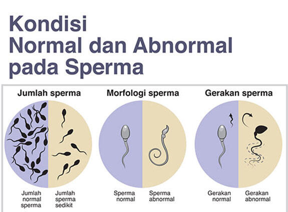 Istri Tak Kunjung Hamil, Bisa Jadi Suami yang Bermasalah