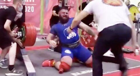 Tak Kuat Angkat Beban 408 Kg, Lutut Pria Ini Langsung Patah