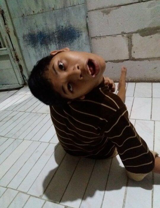 Seberapa Hebat Menurutmu Orang Tua yang Menerima Anaknya yang Memiliki Kelainan?