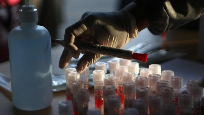 Pecah Rekor, Ini Sebaran 3.560 Pasien Corona yang Sembuh Per 24 Agustus