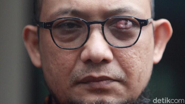 Novel Baswedan Positif Corona