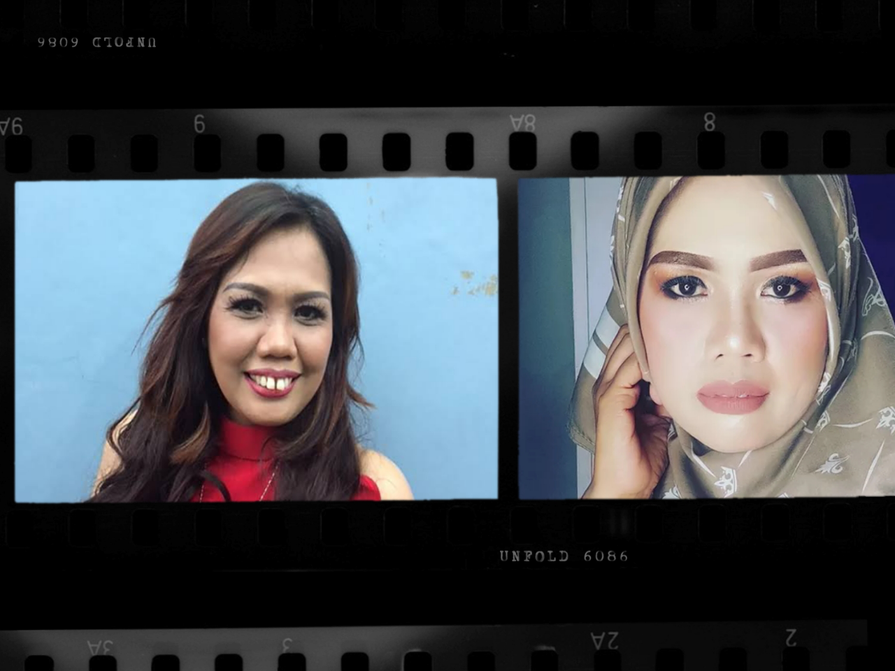 Metamorfosis Elly Sugigi, Beauty is Pain atau Cantik itu Mahal?