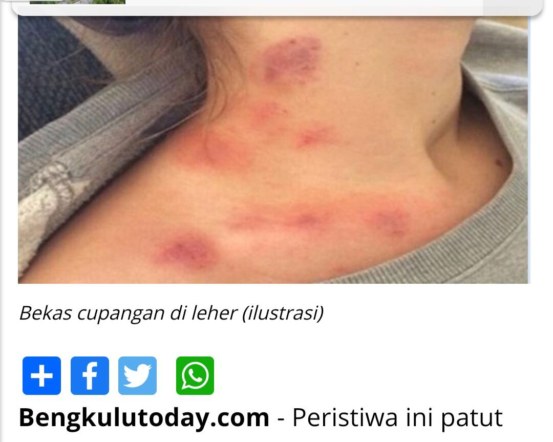 &#91;COCupang&#93; (Bukan Sejarah) Usul Asal, Alasan Penyebutan Cupang Oleh Warga +62
