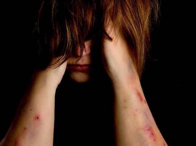 Kepo Self Harm: Makna, Penyebab, Mitos, dan Penyikapan Guys!