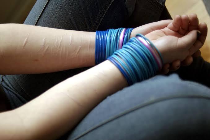 Kepo Self Harm: Makna, Penyebab, Mitos, dan Penyikapan Guys!
