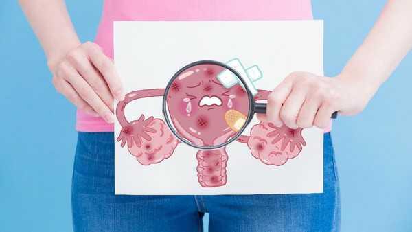 Enam Hal Ini Bisa Menjadi Indikasi Seorang Sista Berpotensi Mandul, Nauzubillah!