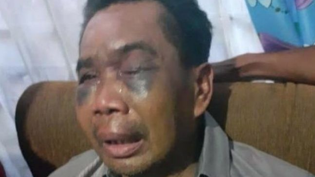 Sarpan Cabut Laporan Sudah Disiksa Polisi Polsek Percut Sei Tuan