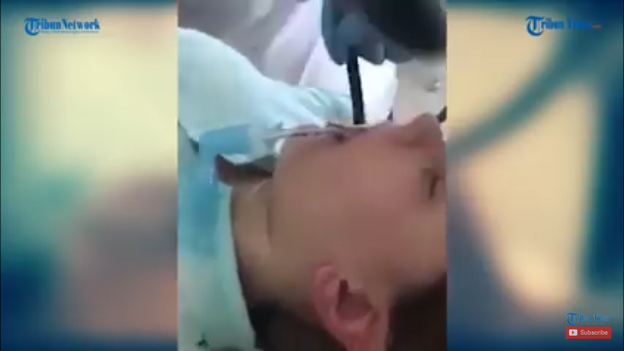 Mengerikan! Viral Video Wanita Saat Makhluk Diduga Ular Dikeluarkan dari Mulutnya