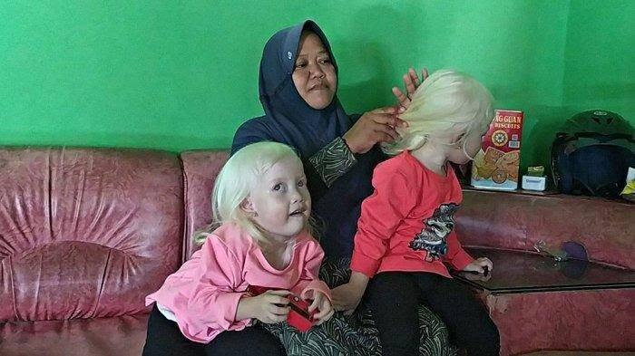 Anak Bule Kembar Lahir Dari Orang Tua Asal Jawa, Sering Dikira Pengasuhnya