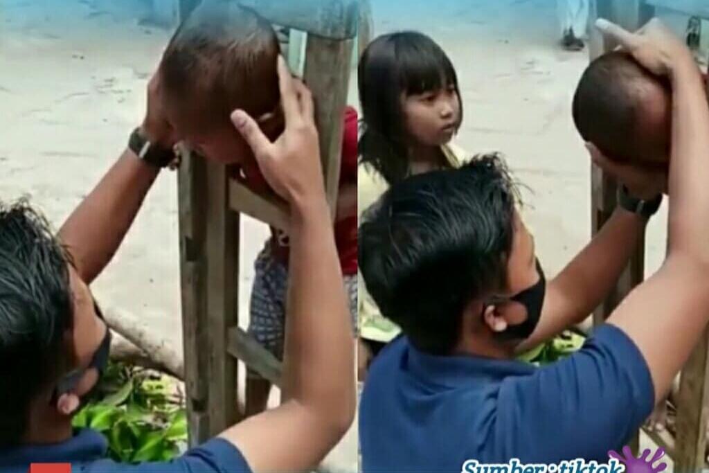 Kepala Bocah Terjebak di Sebuah Tangga, Seorang Pria Mengevakuasinya Dengan Cara ini!
