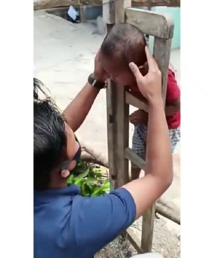 Kepala Bocah Terjebak di Sebuah Tangga, Seorang Pria Mengevakuasinya Dengan Cara ini!