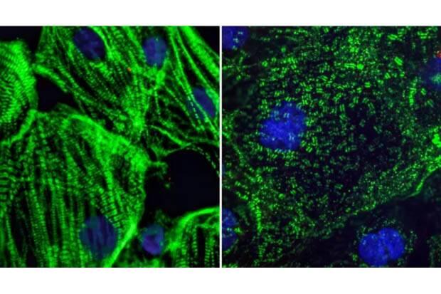 Virus Corona Makin Berbahaya, Potong Serat Otot Jantung Jadi Potongan Kecil