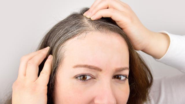 Cara Alami Yang Ampuh Menghilangkan Rambut Uban Di Usia Muda