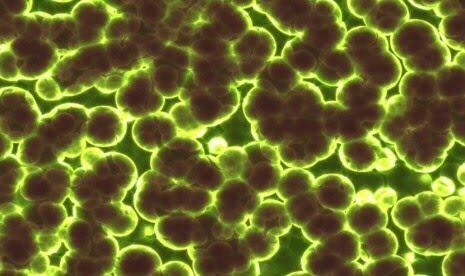 Pabrik Biofarmasi China BOCOR, Ribuan Orang Kena Bakteri